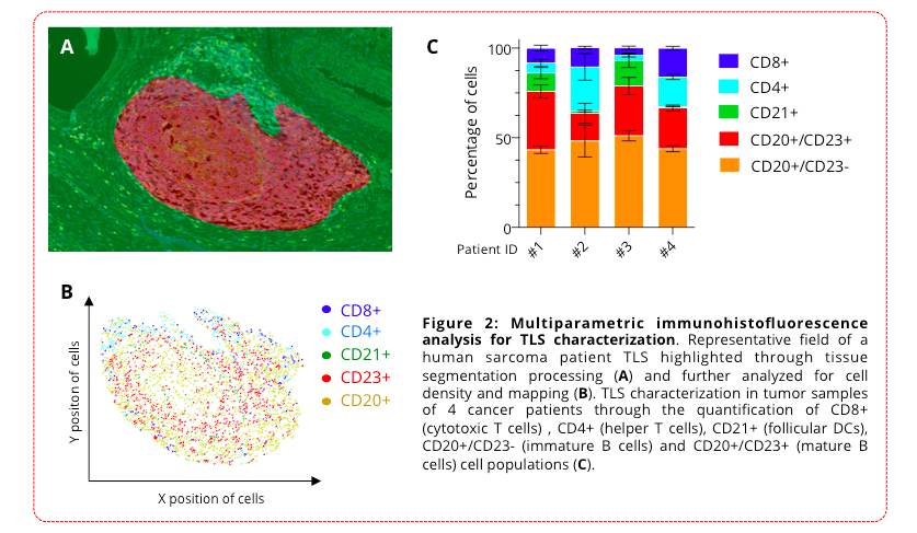 Multiparametric immunohistofluorescence analysis for TLS characterization. Representative field of a human sarcoma patient TLS highlighted through tissue segmentation processing (A) and further analyzed for cell density and mapping (B). TLS characterization in tumor samples of 4 cancer patients through the quantification of CD8+ (cytotoxic T cells) , CD4+ (helper T cells), CD21+ (follicular DCs), CD20+/CD23- (immature B cells) and CD20+/CD23+ (mature B cells) cell populations (C).