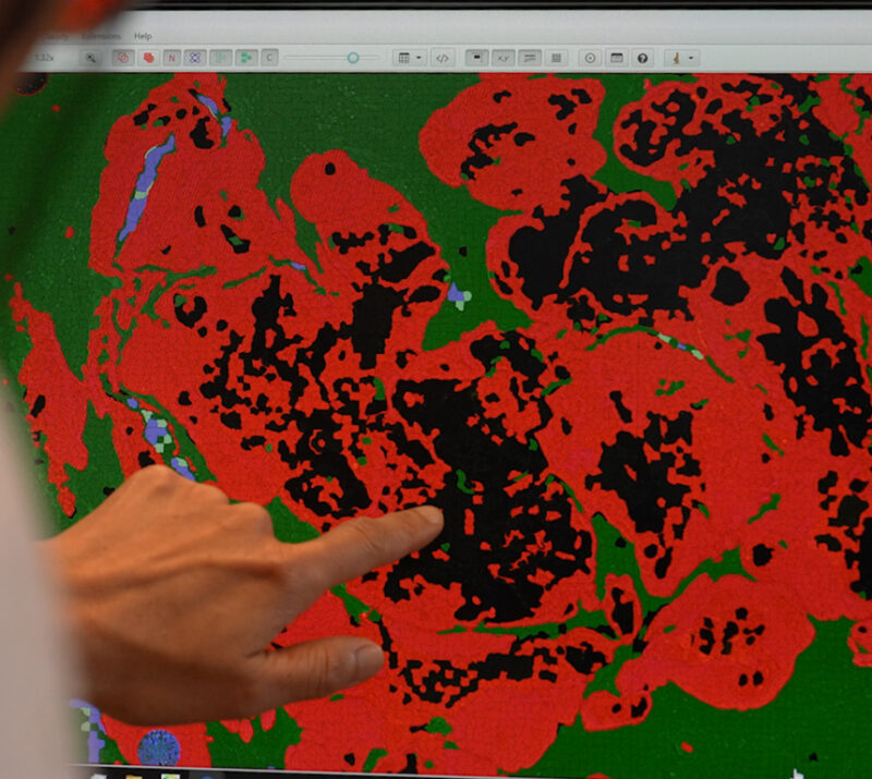 mIF & IHC Image Analysis Services for Digital Pathology mIF & IHC Image Analysis Services for Digital Pathology
