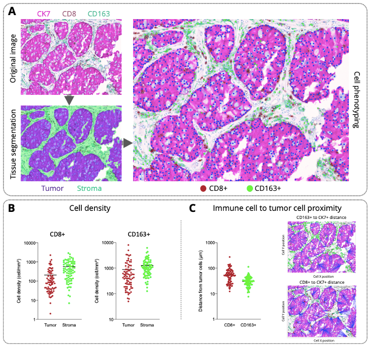 Quantitative histology_Tumor immune contexture_Digital pathology