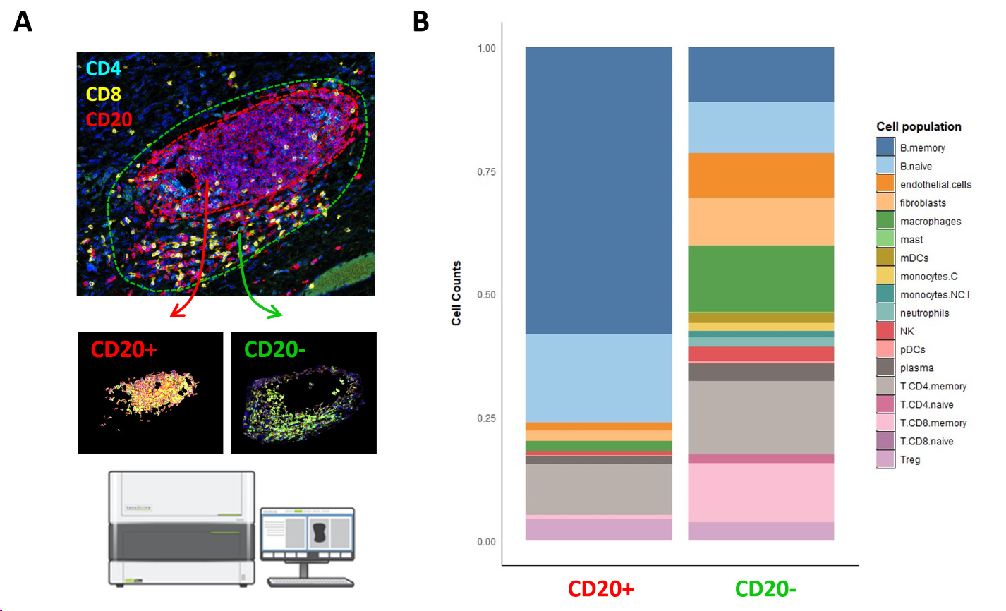 digital spatial profiling analysis services immuno-oncology tumor biopsies TLS