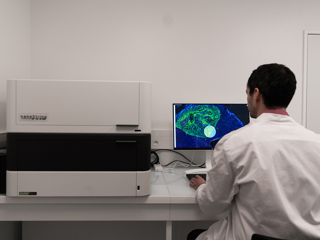 Spatial Transcriptomics CRO Services I GeoMx platform by Nanostring