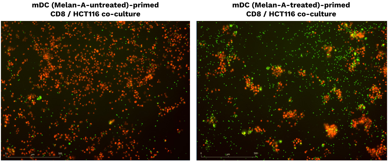 Specific enhanced DC-mediated priming of CD8 T cells induces adaptive T cell-mediated killing towards SK-MEL-5 tumor cells