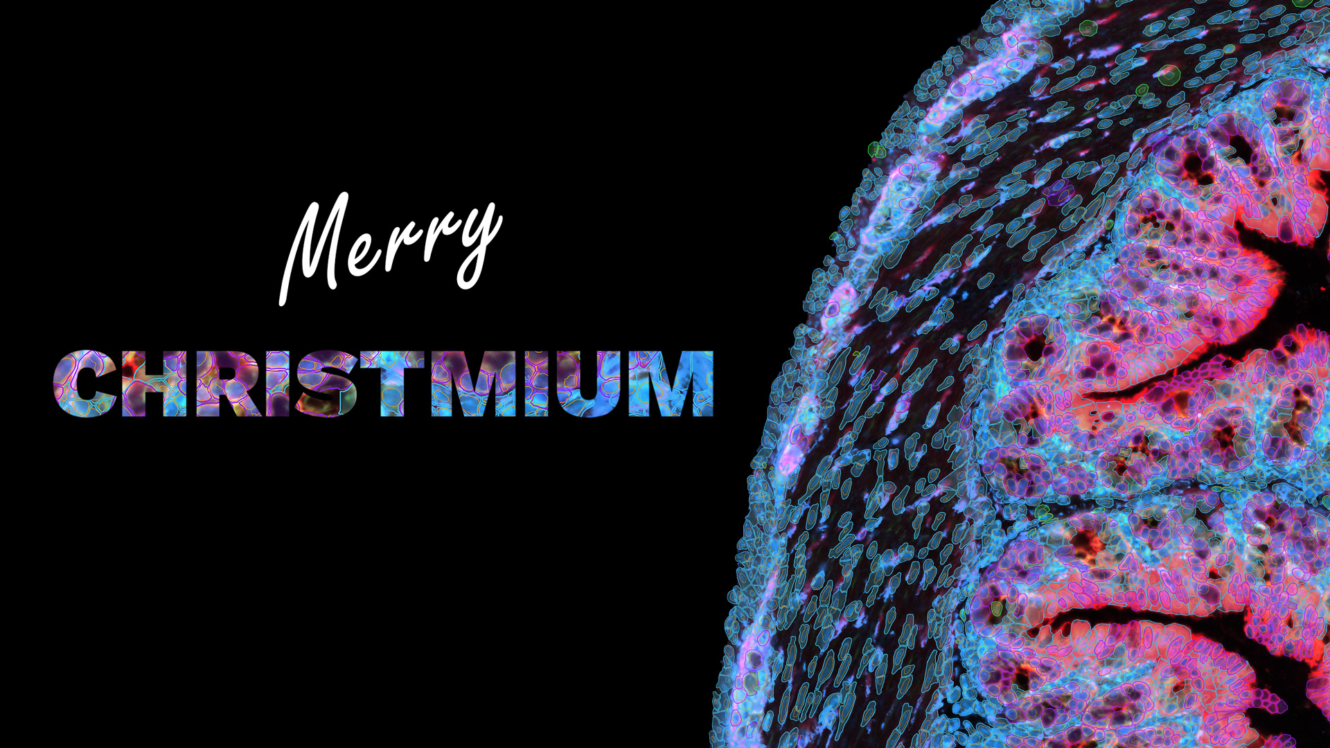 christmium xenium platorm IO panel single cell spatial transcriptomics