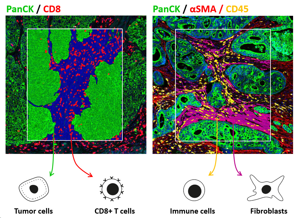 Spatial transcriptomics image analysis mapping segmentation CRO immuno-oncology