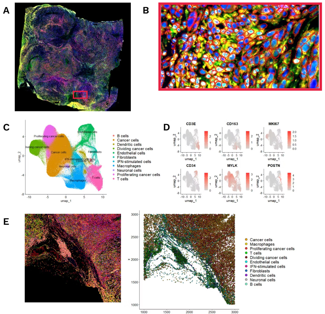 Xenium services CRO oncology single cell spatial transcriptomics