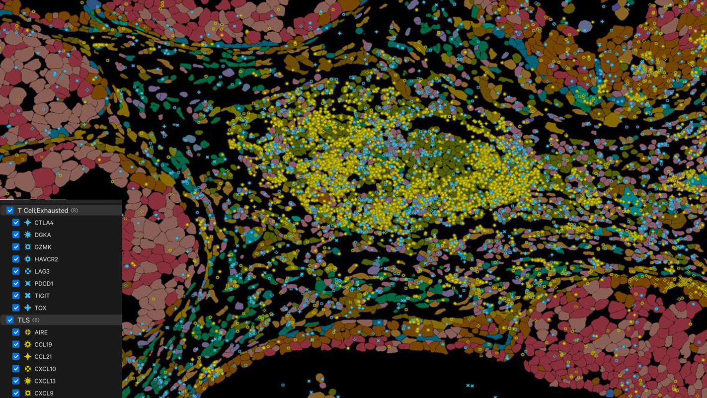 xenium data analysis single-cell spatial transcriptomics custom services oncology CRO