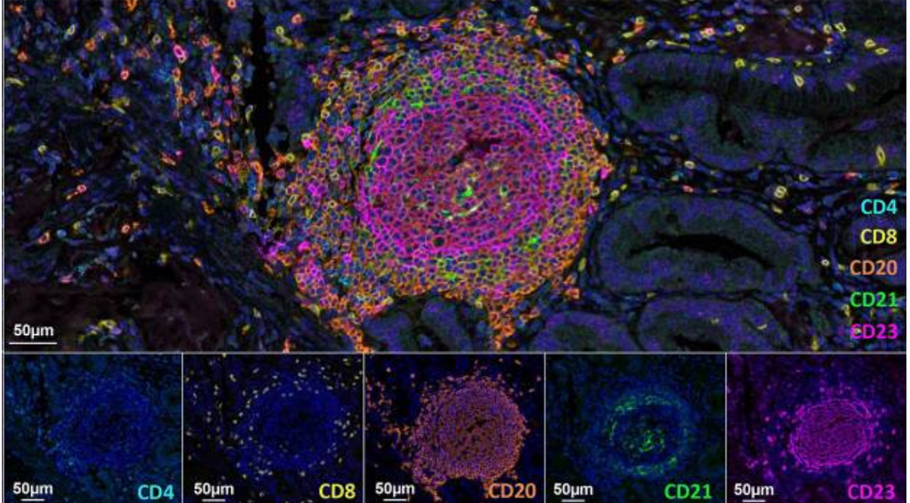 digital pathology FFPE tumor samples