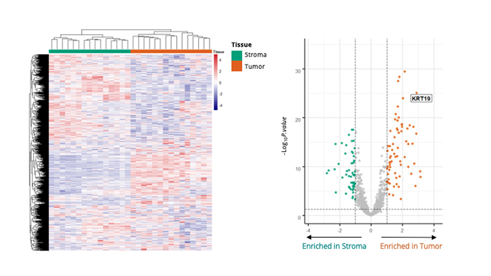 human tumor sample image analysis bioinformactics data science