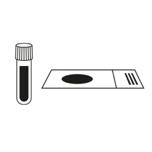 ADC translational studies biomarkers analysis target expression ADC translational studies biomarkers analysis target expression