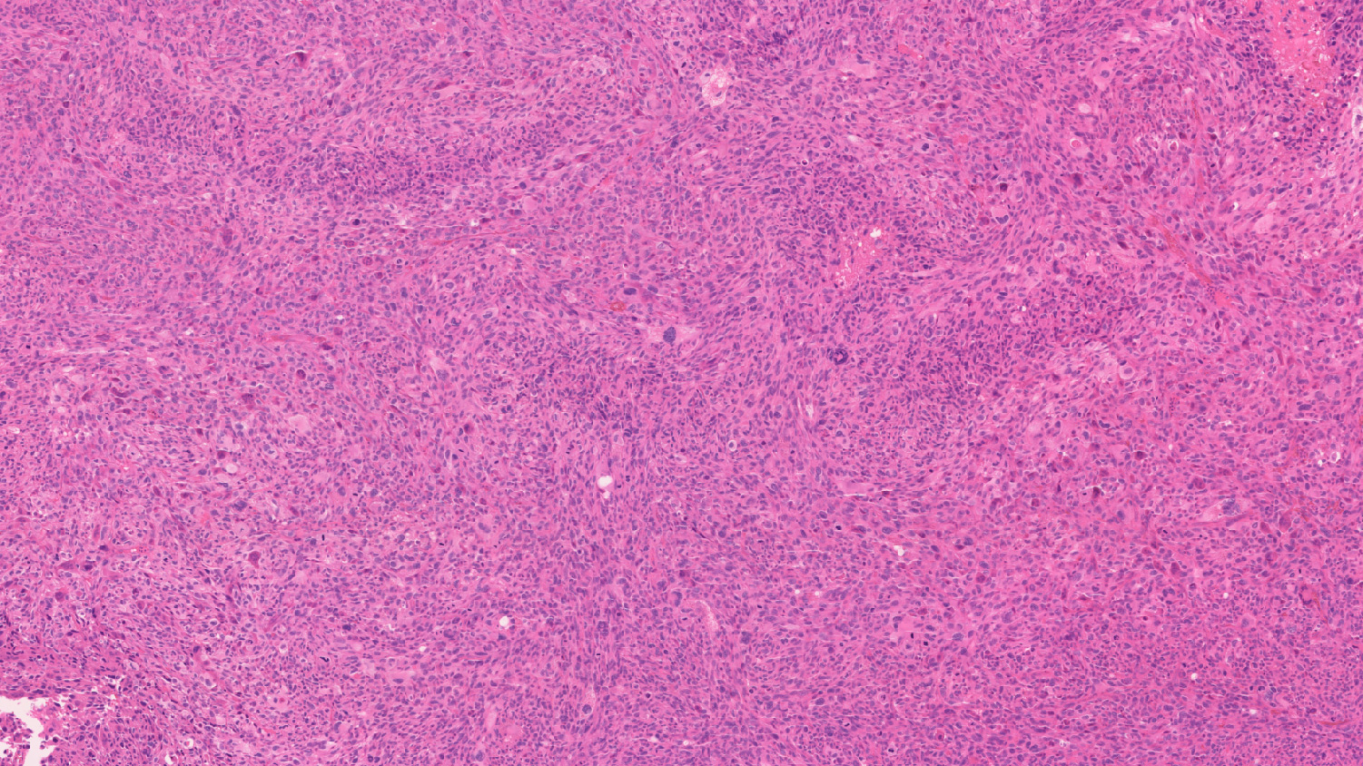 Visium HD Services CRO 10x genomics spatial gene expression profiling
