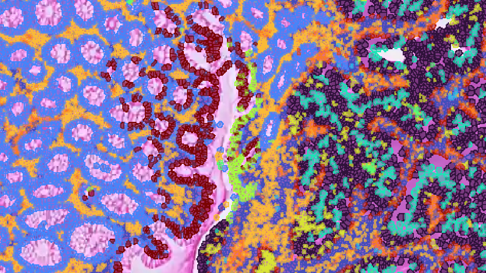 Visium HD Whole transcriptome services CRO spatial transcriptomics Visium HD Whole transcriptome services CRO spatial transcriptomics