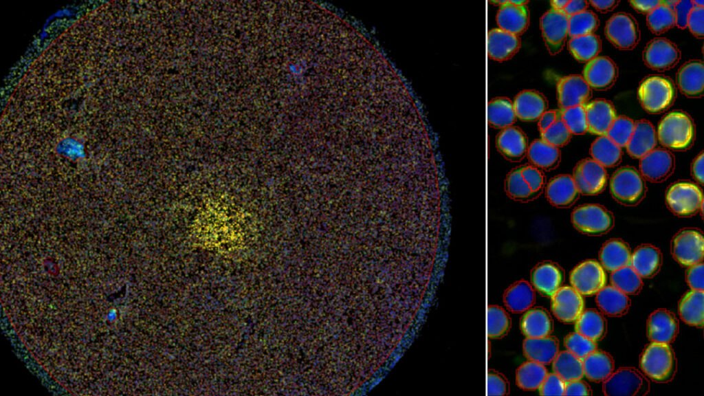 Xenium single-cell segmentation STAMP workflow Explicyte Xenium single-cell segmentation STAMP workflow Explicyte