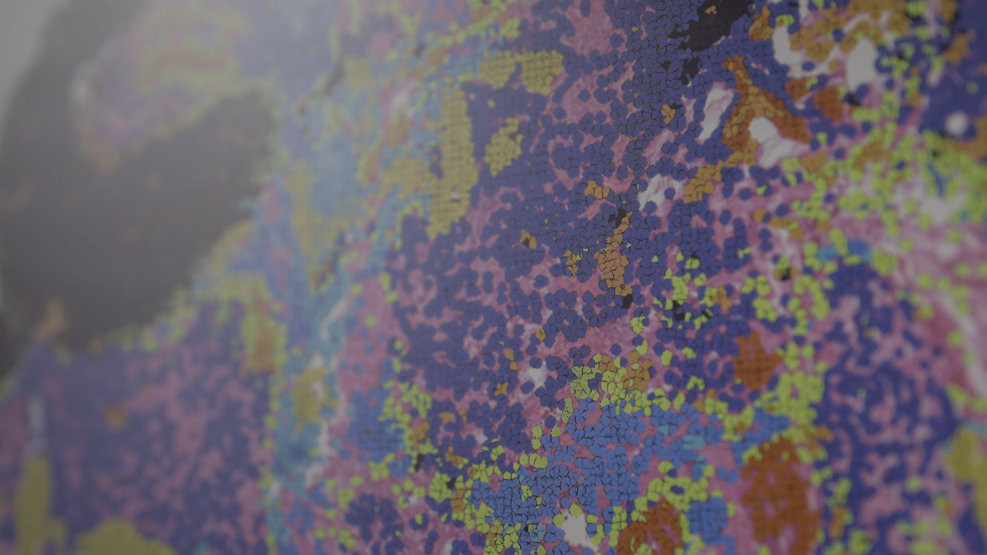 Chromium visium xenium transcriptomics CRO oncology