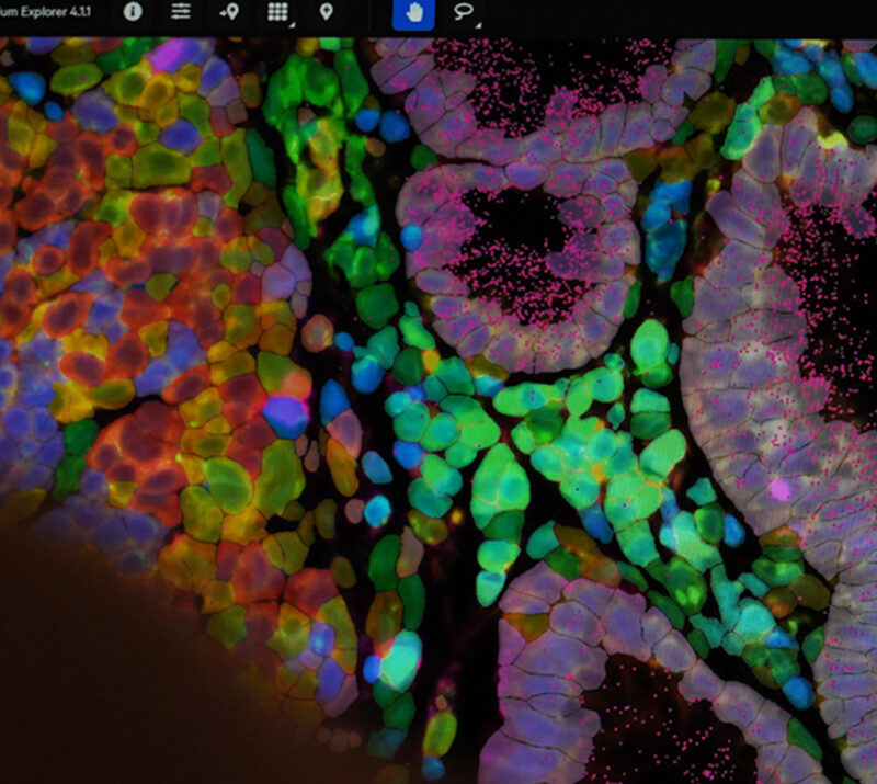 10x Genomics Data Analysis Services (Chromium X, Visium HD & Xenium) 10x Genomics Data Analysis Services Chromium X Visium HD Xenium bioinformatics