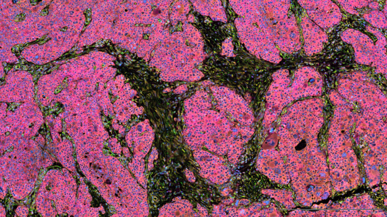 Analysis of 10x Genomics Xenium Single-Cell Transcriptomic Data Analysis of 10x Genomics Xenium Single-Cell Transcriptomic Data