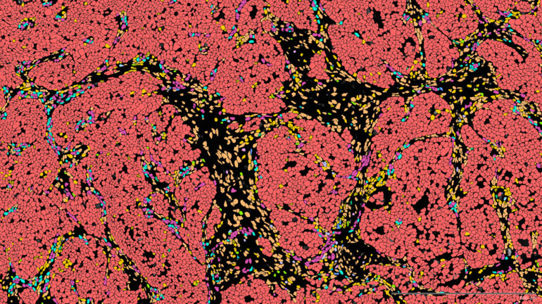 Bioinformatics Analysis of Xenium Single-Cell Transcriptomics Data Bioinformatics Analysis of Xenium Single-Cell Transcriptomics Data