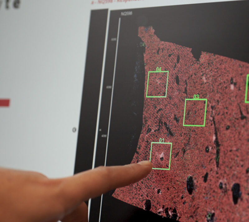 Bulk RNA-seq & GeoMx DSP Dataset Analysis services Bulk RNA-seq & GeoMx DSP Dataset Analysis services explicyte