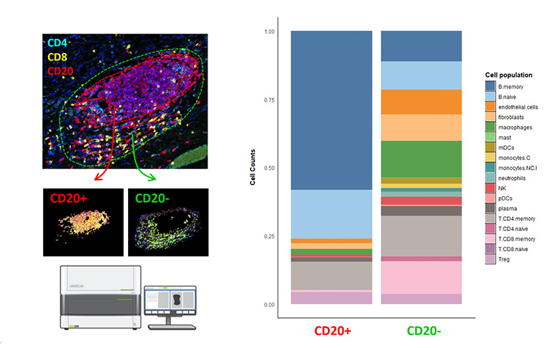 Estimation of immune cell composition based on data deconvolution-GeoMx data analysis Estimation of immune cell composition based on data deconvolution-GeoMx data analysis