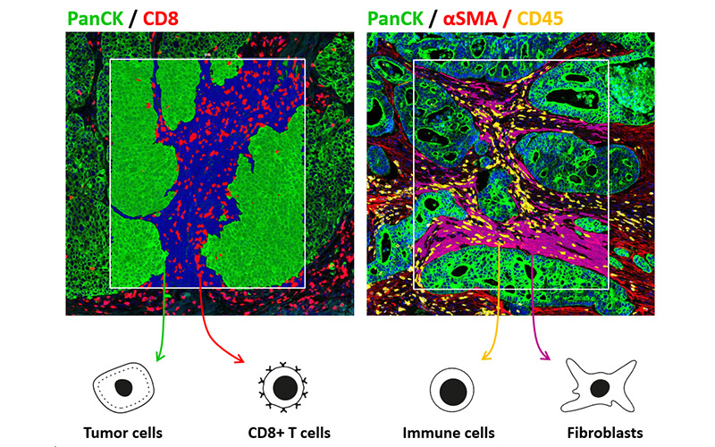 GEOMX Nanostring data analysis services bioinformatics GEOMX Nanostring data analysis services bioinformatics