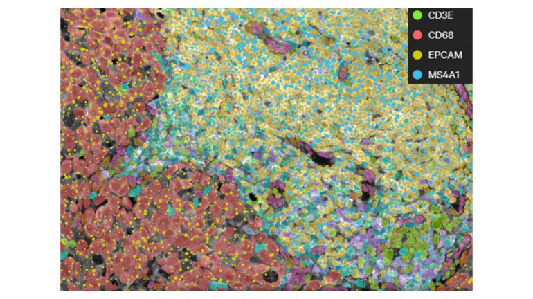 Single-Cell Gene Expression Analysis from Xenium Data Single-Cell Gene Expression Analysis from Xenium Data
