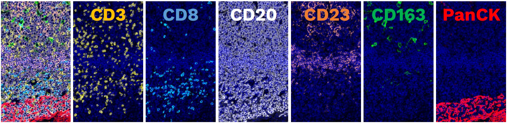 immune contexture tls macrophage panel IHF