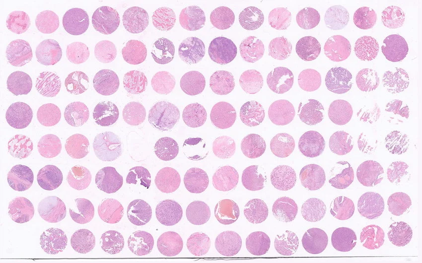 FFPE normal tissue sourcing