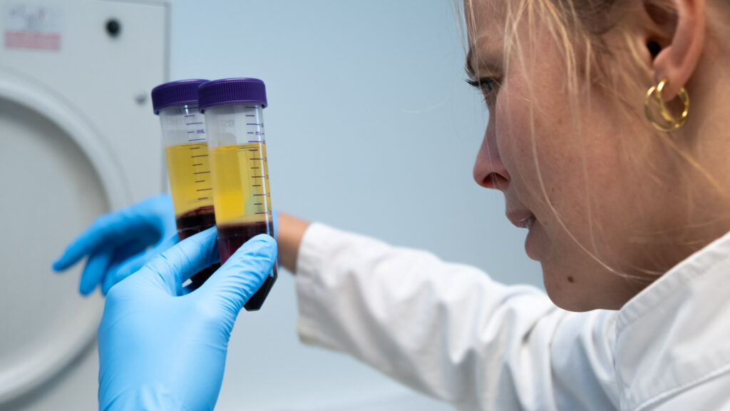 peripheral biomarker analysis in blood samples