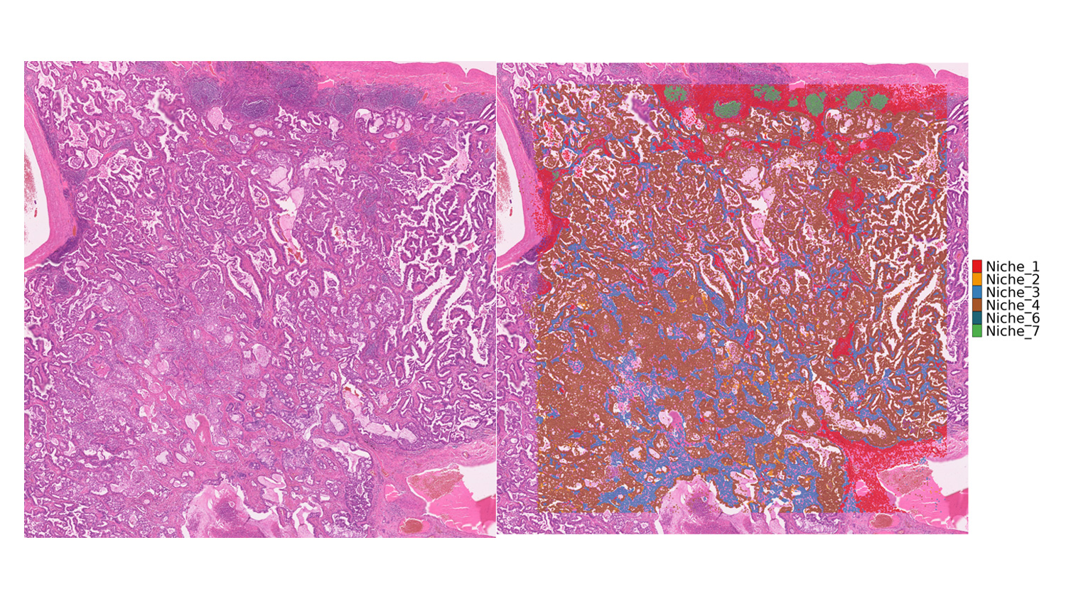 Visium HD Spatial Whole Transcriptome Data Analysis