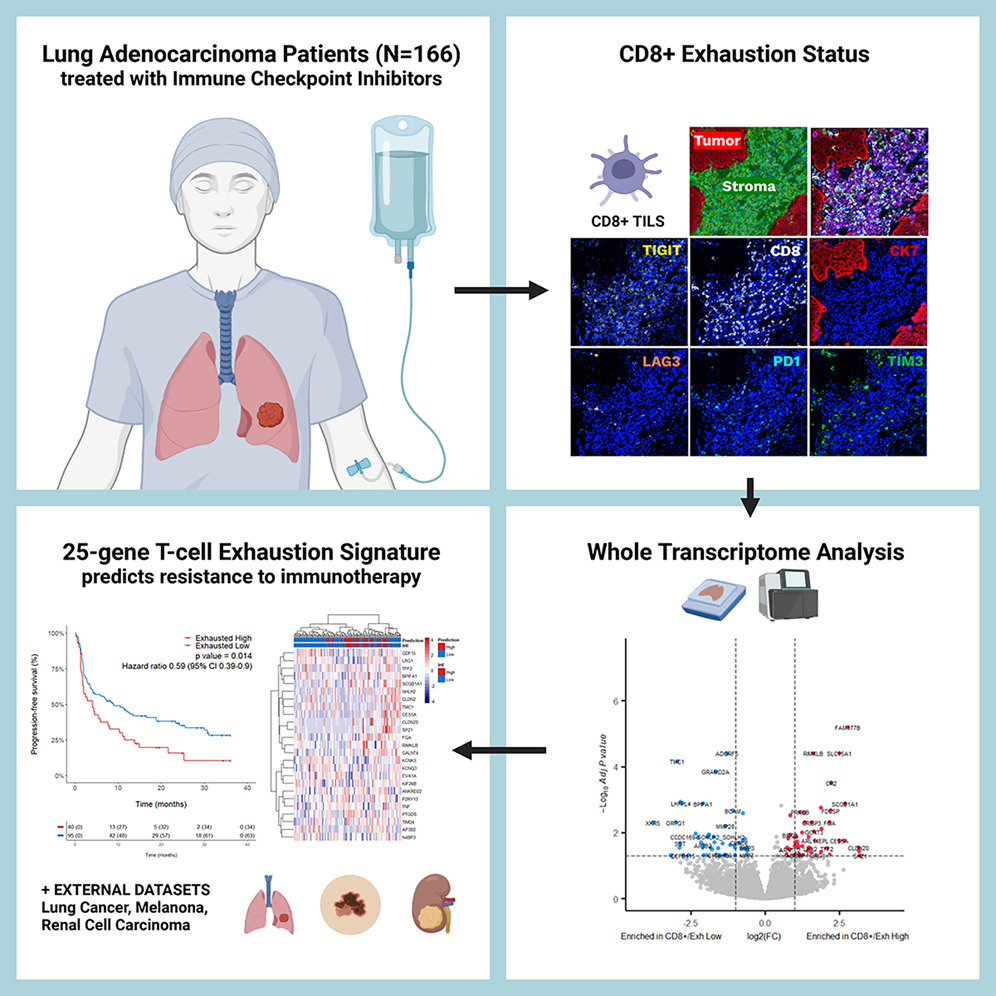 A 25-gene exhaustion signature associated with immunotherapy response